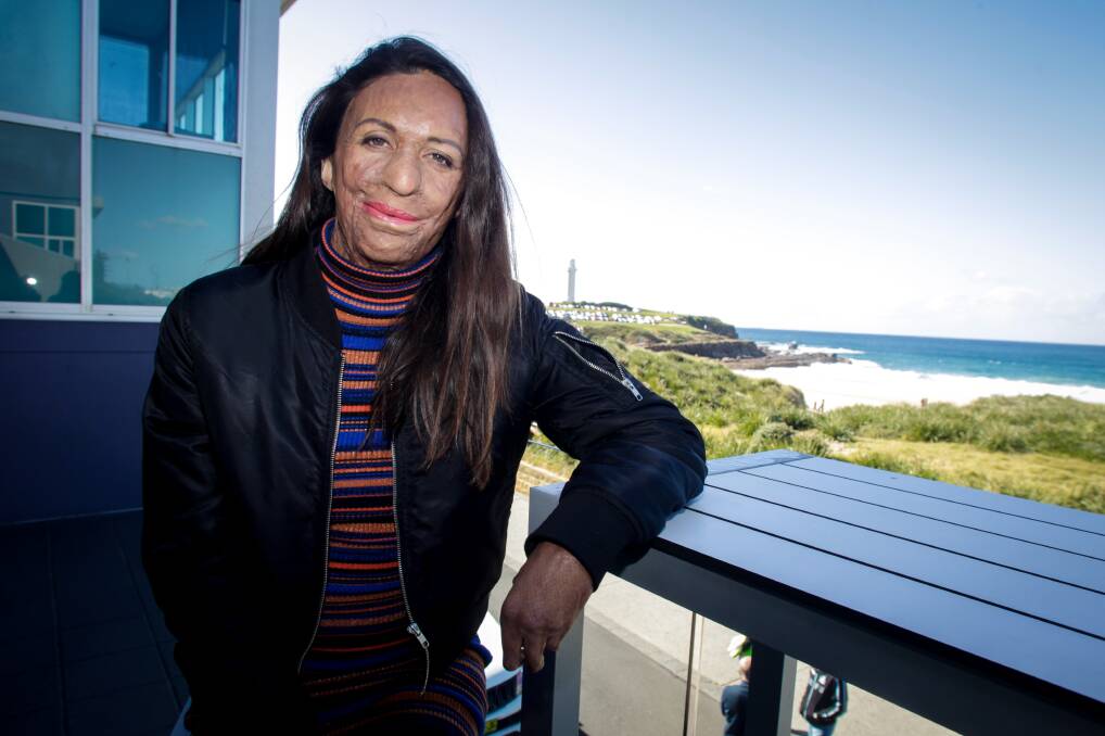 Inspirational address: Turia Pitt loved the response from Illawarra businesswomen so much two years ago she was eager to speak at a second IWIB lunch. Picture: Georgia Matts.
