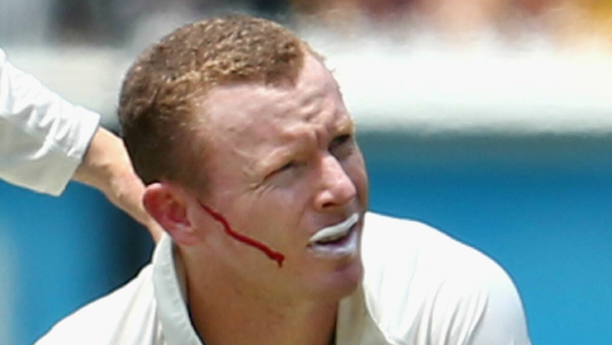 Chris Rogers is treated after being struck in the helmet during the Ashes series against England. Rogers says he's never been more ready to take on the powerful South African bowling line-up.