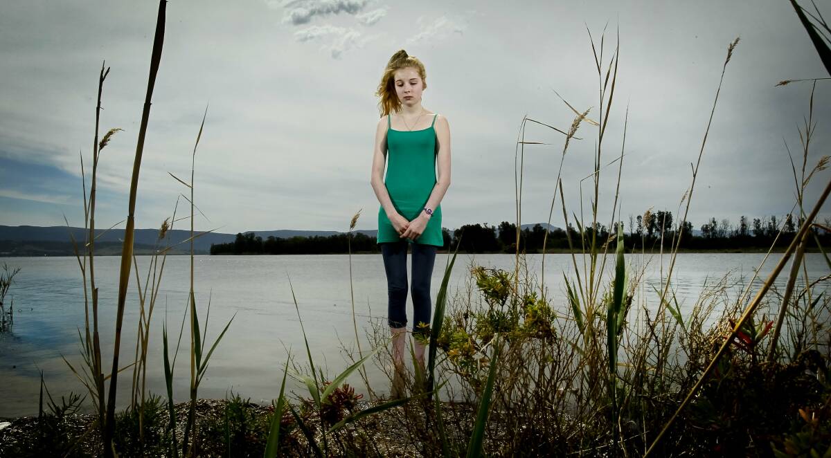 Anorexia patient Chloe Swinfield. Picture: DAVE TEASE